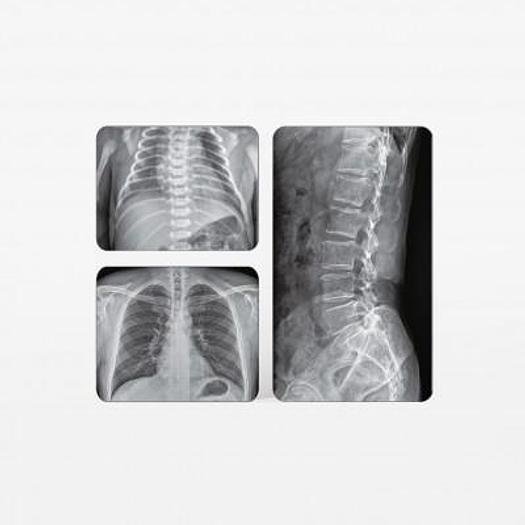 SALLE RADIO POUMON NUMÉRIQUE, TABLE FLOTTANTE, POTIER VERTICAL, CAPTEUR PLAT – Image 3