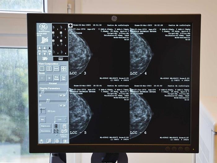 mammographe 3D GE Senoclaire de General Electric – Image 4